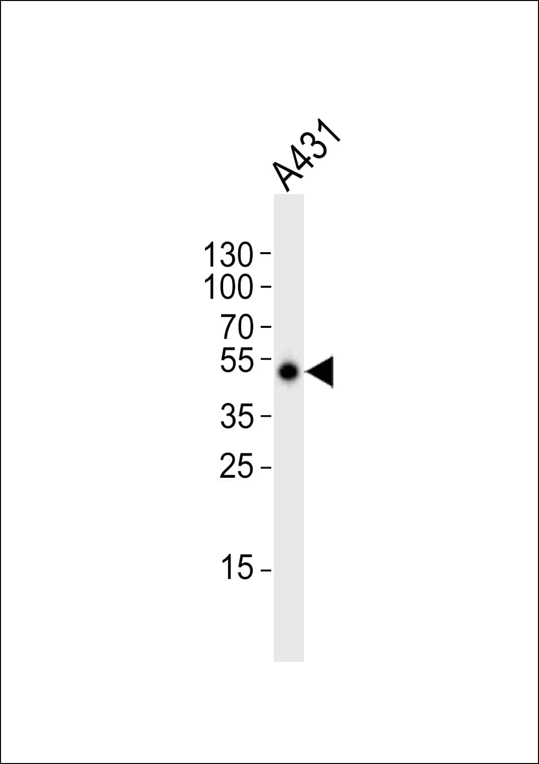 IHC-plus™ Polyclonal Rabbit anti-Human EFTU / TUFM Antibody (aa112-147, IHC, IF, WB)