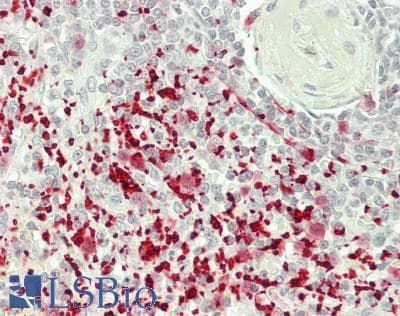 F13A1 / Factor XIIIa Antibody (clone 6F5, Carrier-free)
