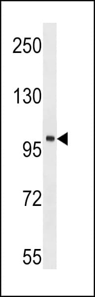 TNK2 / ACK1 Antibody (aa934-964)