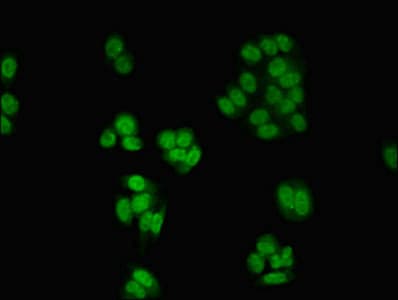 Polyclonal Rabbit anti-Human CSNK2A1 Antibody (aa1-391)