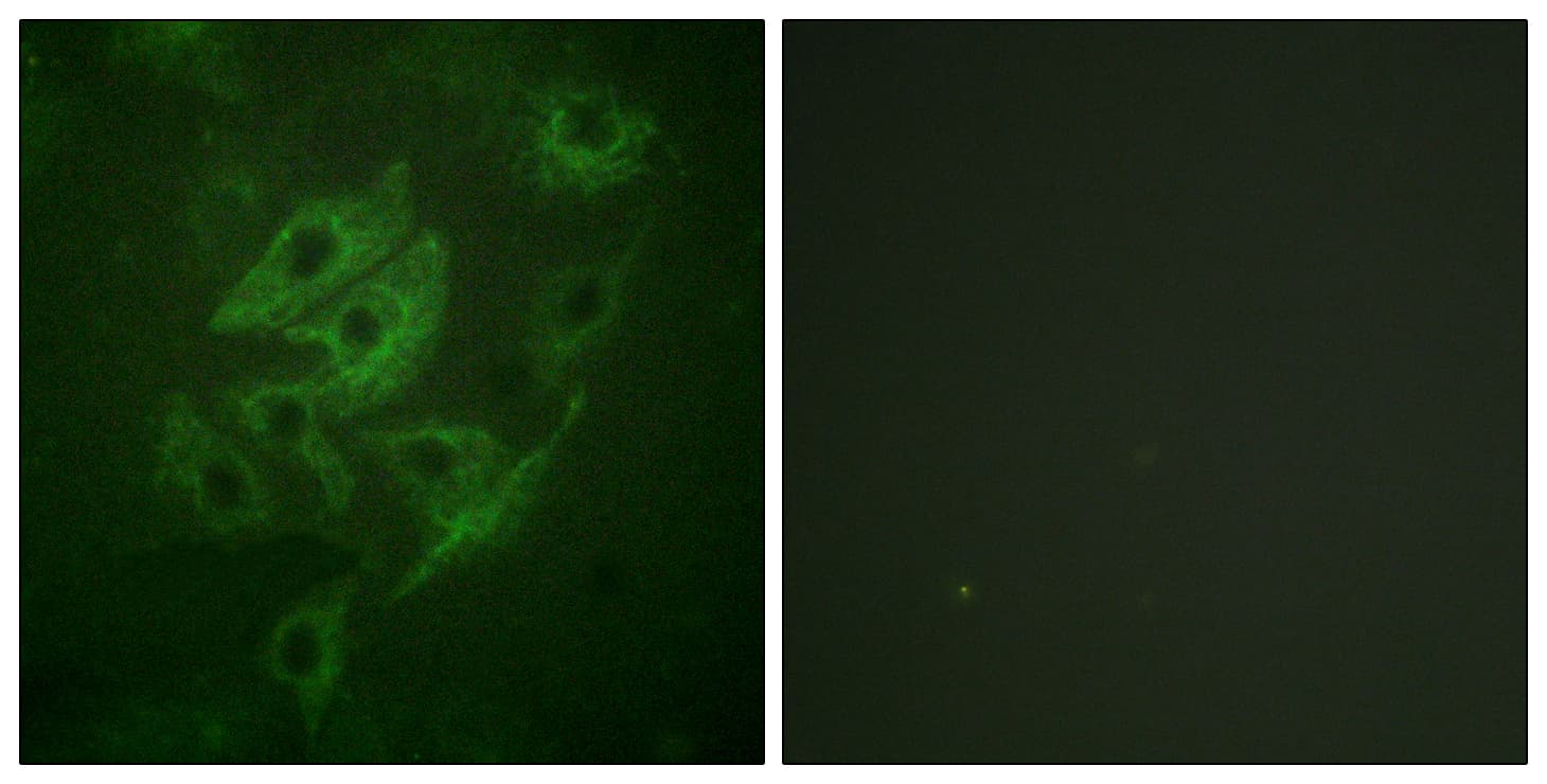 Polyclonal Rabbit anti-Human GRIN2A+GRIN2B Antibody (aa1216-1265, IHC, IF)