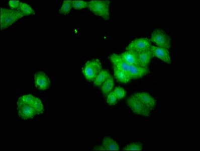Polyclonal Rabbit anti-Human THEMIS / SPOT Antibody (IF, WB)