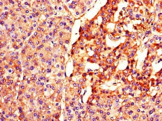 BTRCP / BETA-TRCP Antibody