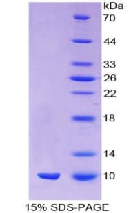 Mouse EMA / MUC1 Protein (Recombinant His)
