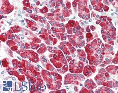 IHC-plus™ Polyclonal Rabbit anti-Human CPB / Carboxypeptidase B Antibody (IHC)