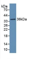 HP / Haptoglobin Antibody (aa70-332)