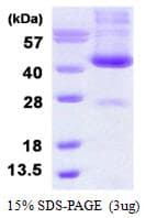 Human ADH6 Protein (Recombinant His)