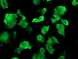MSI1 / Musashi 1 Antibody (clone OTI2G9)