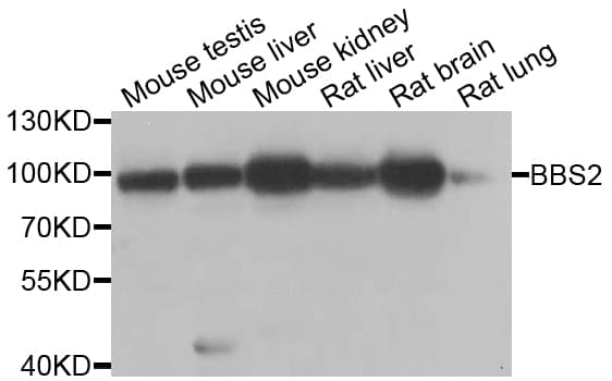 BBS2 / BBS Antibody