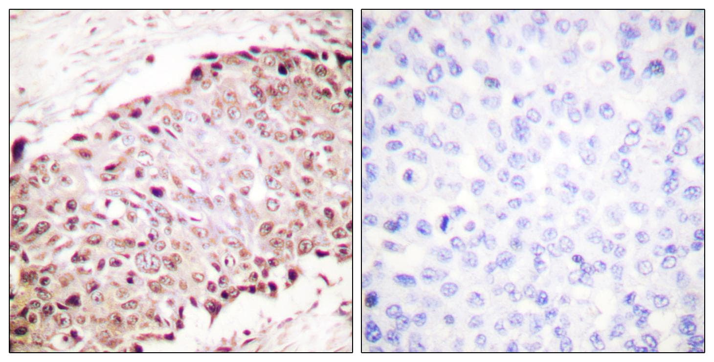 SUMO1 / SMT3 Antibody