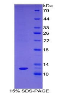 Rat SST / Somatostatin Protein (Recombinant His)