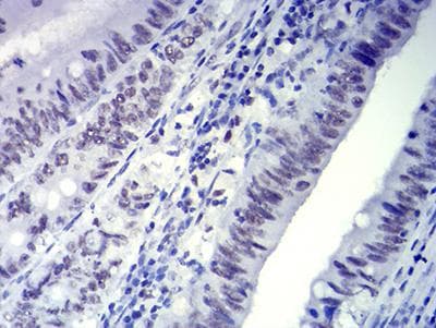 CTNNBL1 / NAP Antibody (clone 3C7F9)