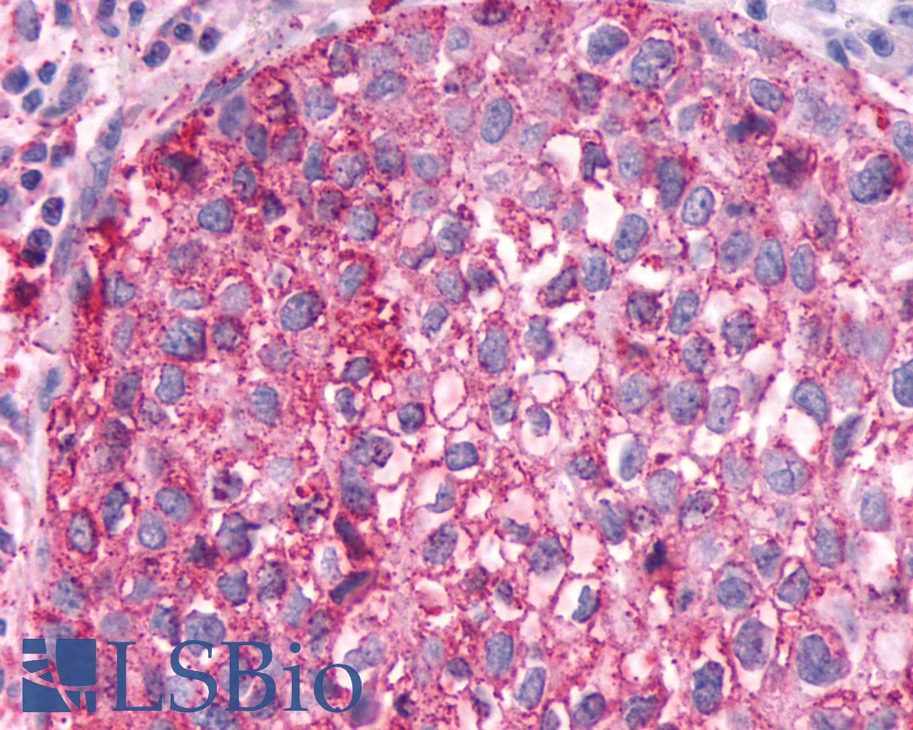 PathPlus™ FZD4 / Frizzled 4 Antibody (C-Terminus)