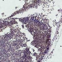HIST1H3H Antibody
