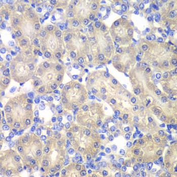 ACY1 / Aminoacylase 1 Antibody