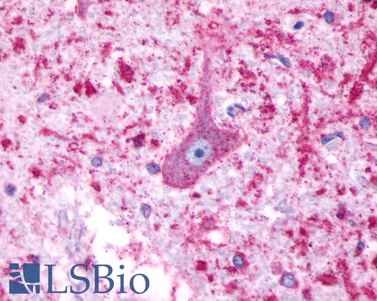 PathPlus™ Polyclonal Rabbit anti-Human HTR4 / 5-HT4 Receptor Antibody (Cytoplasmic Domain, IHC)