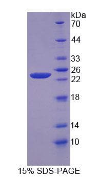 Human TMEM16B / ANO2 Protein (Recombinant His-T7, N-terminus)
