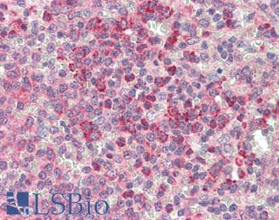 IHC-plus™ NOX5 Antibody