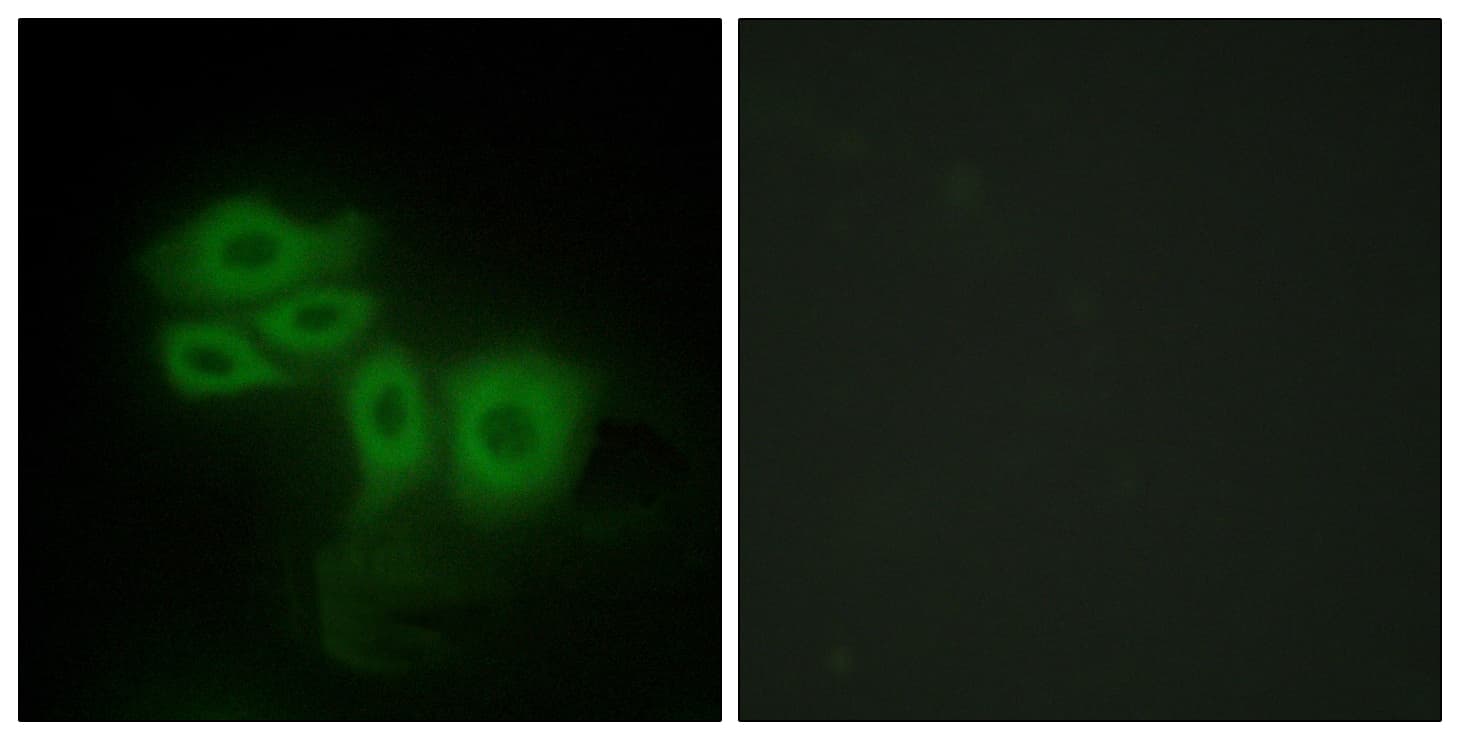 IHC-plus™ SLK Antibody (aa1151-1200)