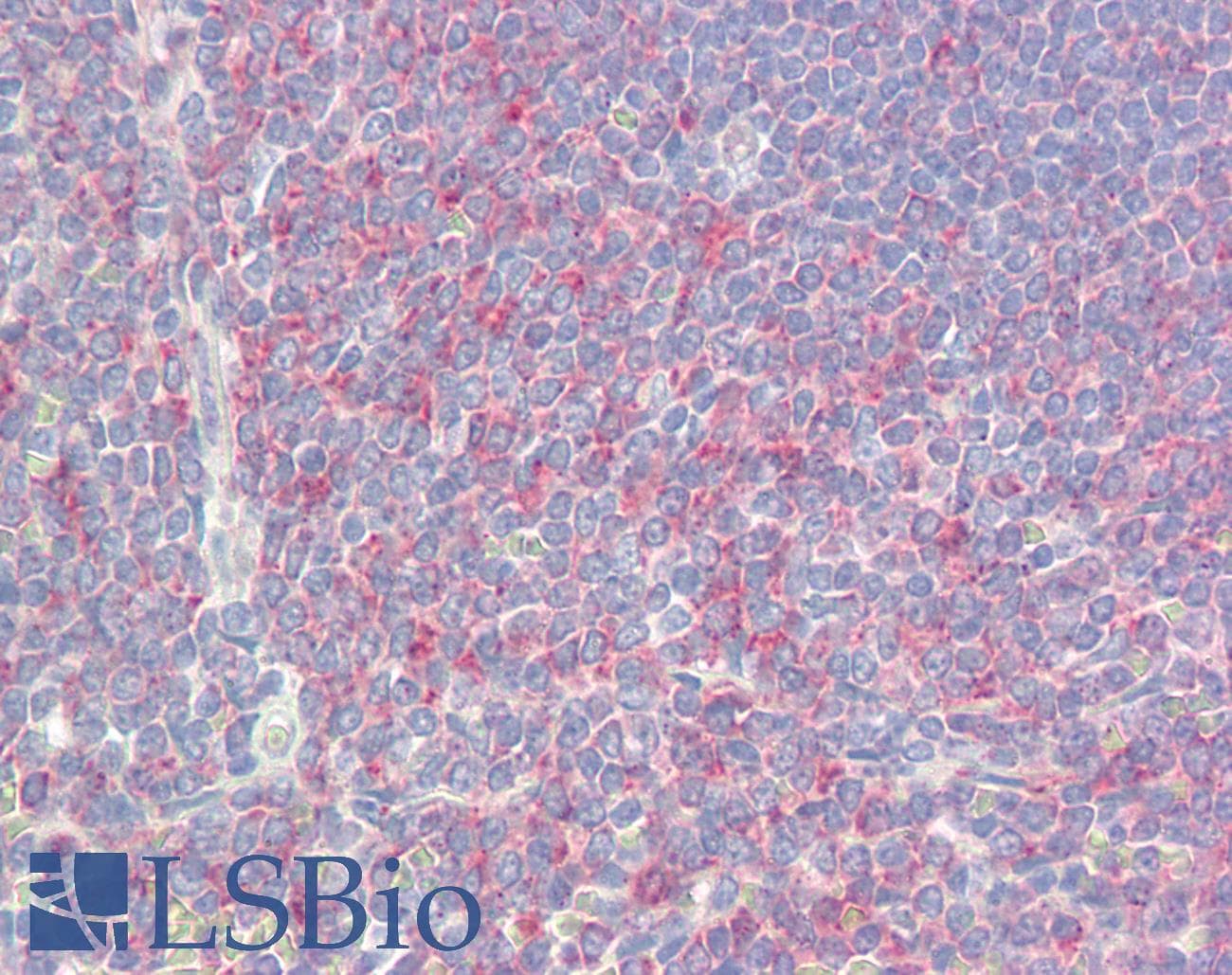 IHC-plus™ Polyclonal Rabbit anti-Human C5orf13 Antibody (aa13-62, IHC)
