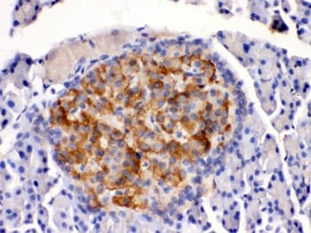 HSD2 / HSD11B2 Antibody
