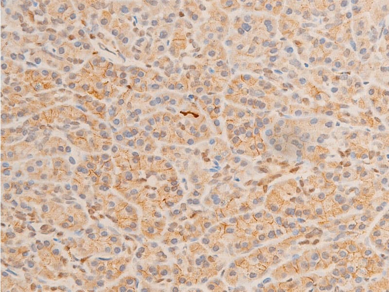HSPB6 / HSP20 Antibody (phospho-Ser16)