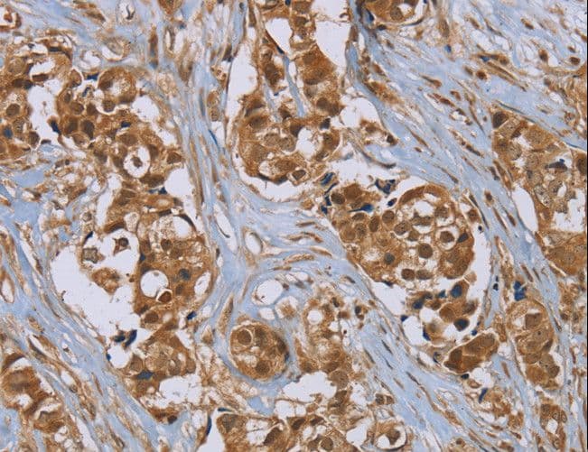 PUS10 Antibody