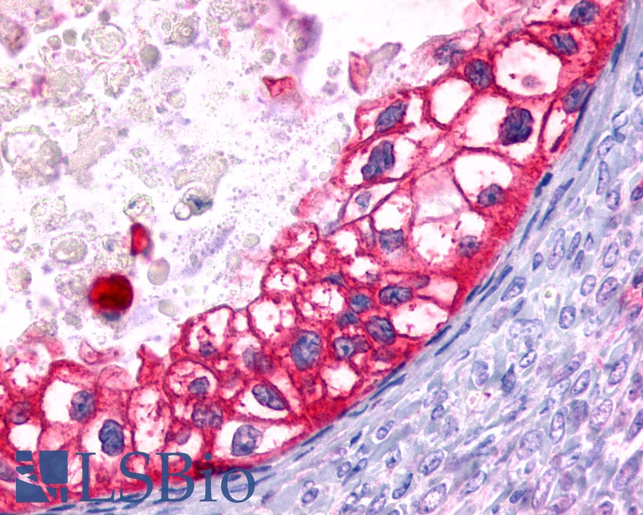 IHC-plus™ FZD7 / Frizzled 7 Antibody (N-Terminus)