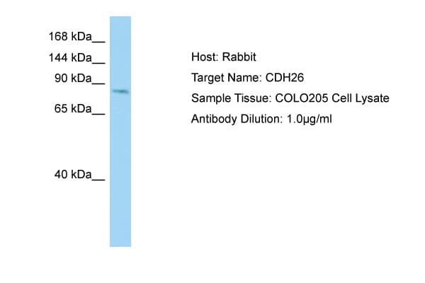 Polyclonal Rabbit anti-Human CDH26 / Cadherin 26 Antibody (aa385-434, WB)