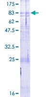 Human CALCR / Calcitonin Receptor Protein (Recombinant GST)