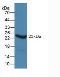 ORM1 / Orosomucoid Antibody (APC)