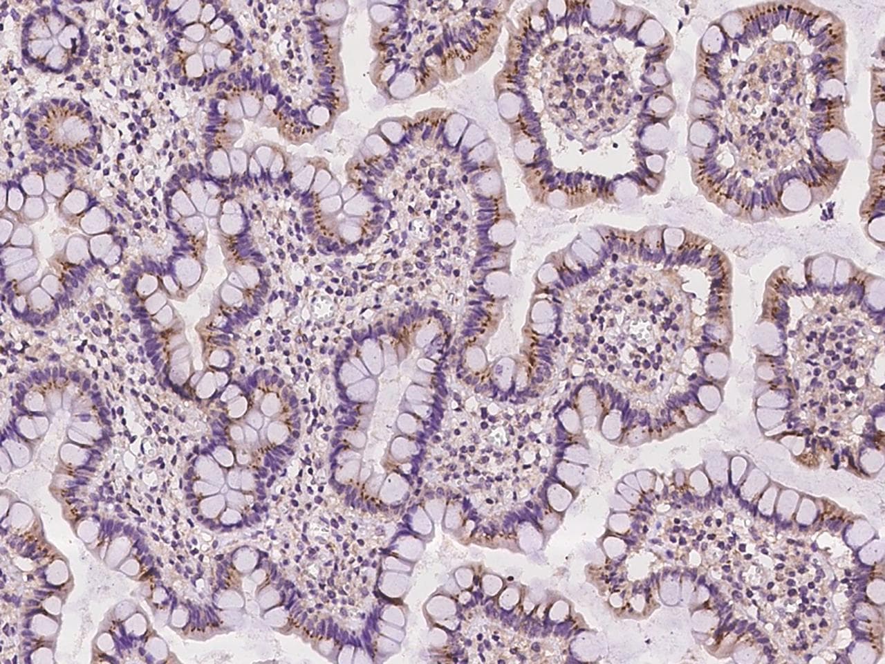 Polyclonal Rabbit anti-Human FAM3B Antibody (IHC)