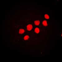 CUX1 / CASP Antibody (N-Terminus)