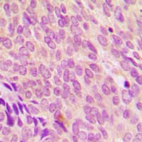 Polyclonal Rabbit anti-Human SDCCAG8 Antibody (C-Terminus, IHC, WB)