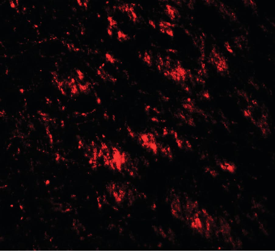 GABARAP Antibody