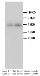 CYP2E1 Antibody (C-Terminus, Magnetic beads)