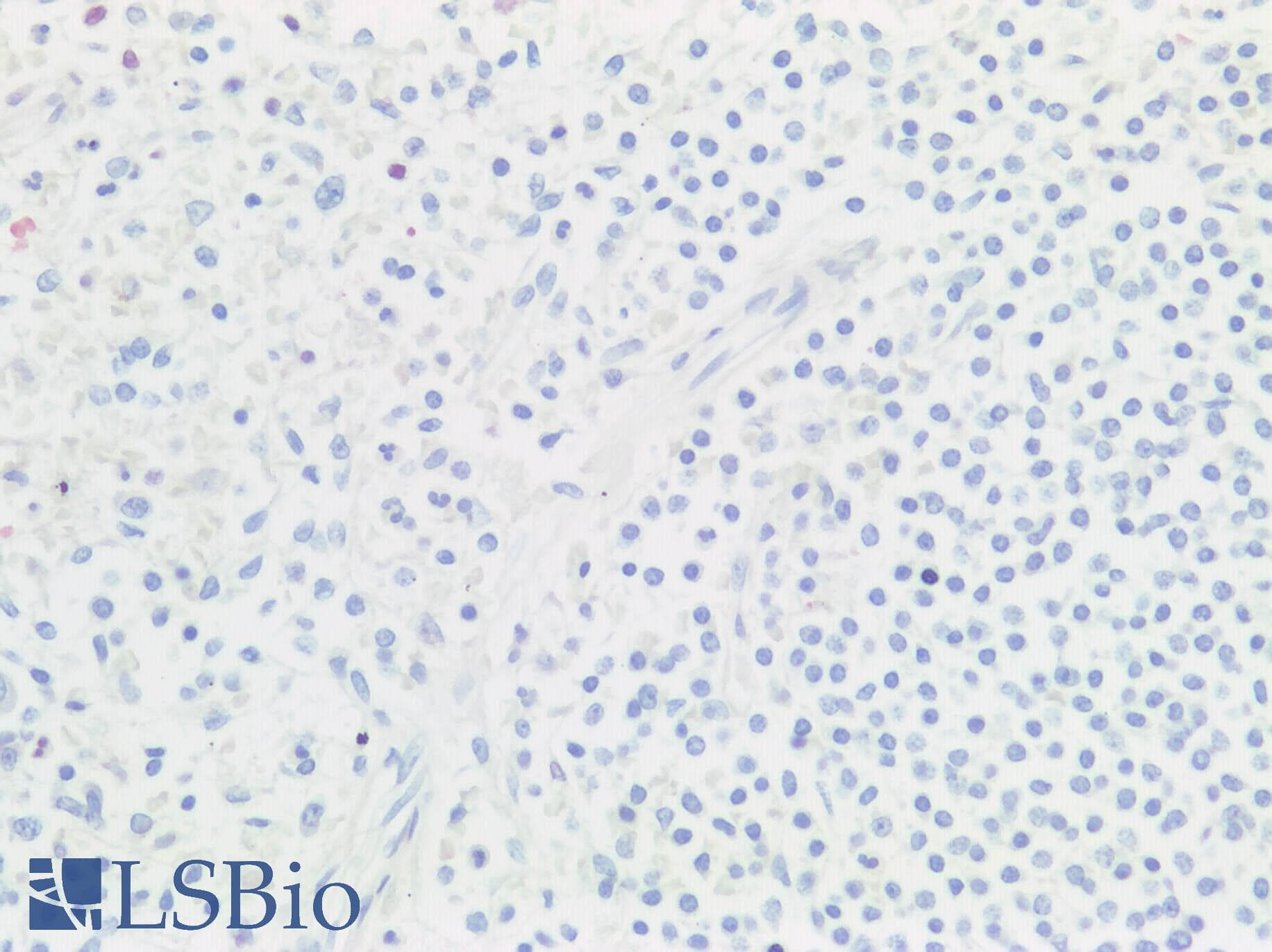 PathPlus™ Polyclonal Rabbit anti-Human BMP6 Antibody (IHC)