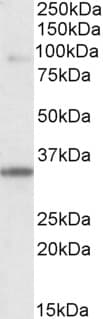 IHC-plus™ LDB3 / ZASP Antibody (aa319-330)