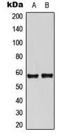 TH / Tyrosine Hydroxylase Antibody (N-Terminus)