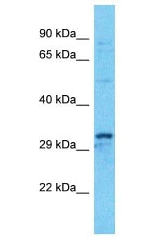 KCTD15 Antibody (aa9-58)