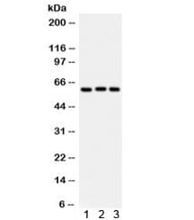 Polyclonal Rabbit anti-Human HPSE / Heparanase Antibody (WB)