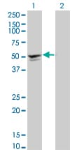 SGCA / DAG2 Antibody (clone 3C4)
