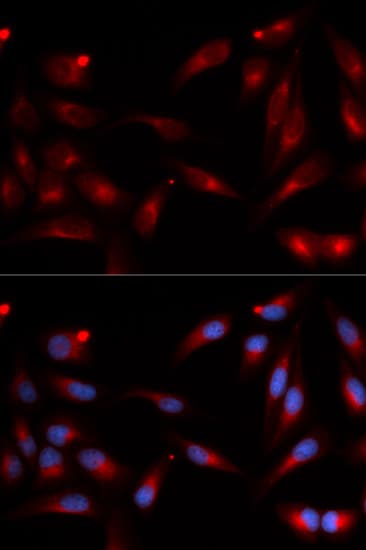 ADAM9 Antibody