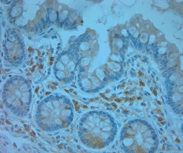 Polyclonal Rabbit anti-Human REEP5 Antibody (aa150-189, IHC)
