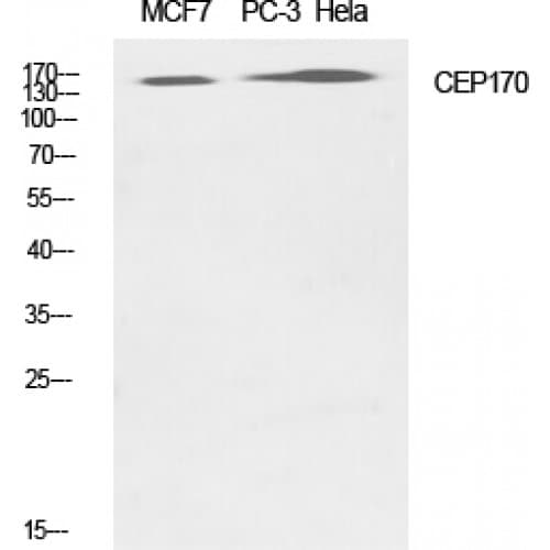 Polyclonal Rabbit anti-Human CEP170 Antibody (670-750 aa, Internal, IHC, WB)
