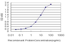 PathPlus™ KRT20 / CK20 / Cytokeratin 20 Antibody (clone 2G3-1C8)