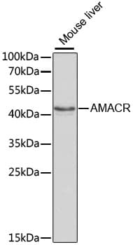 AMACR / P504S Antibody