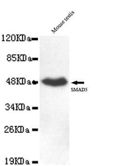IHC-plus™ SMAD5 Antibody (C-Terminus, clone 4B10-B10-B6)