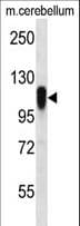 Polyclonal Rabbit anti-Human FBXO41 Antibody (aa235-263, WB)