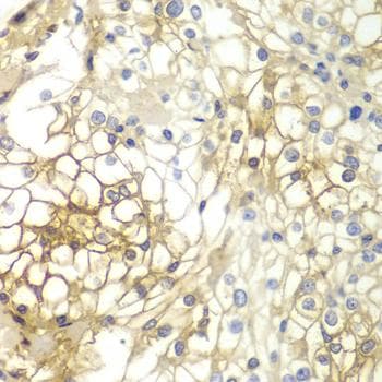 SDC1 / Syndecan 1 / CD138 Antibody